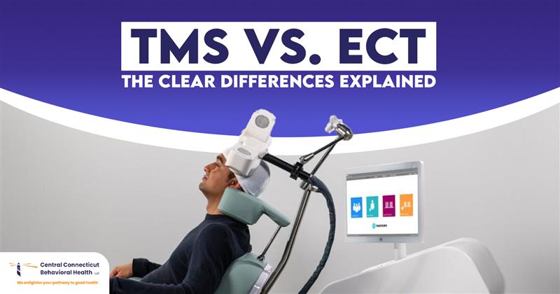 TMS vs ECT: The Differences That Are Majorly Perceivable