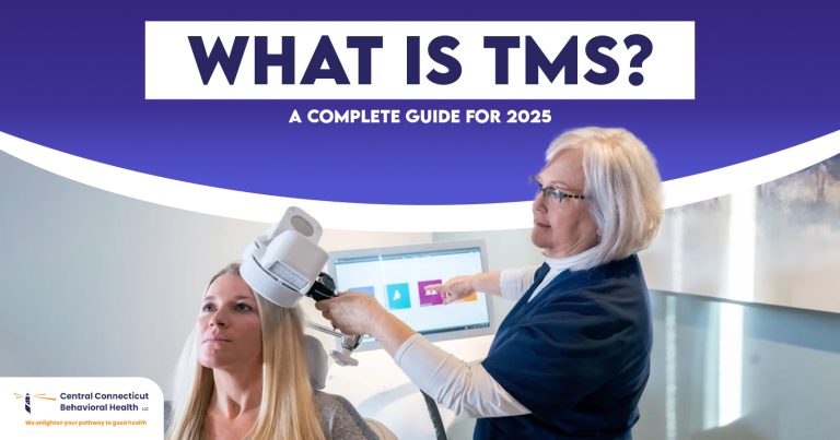 What is TMS A Complete Guide for 2025